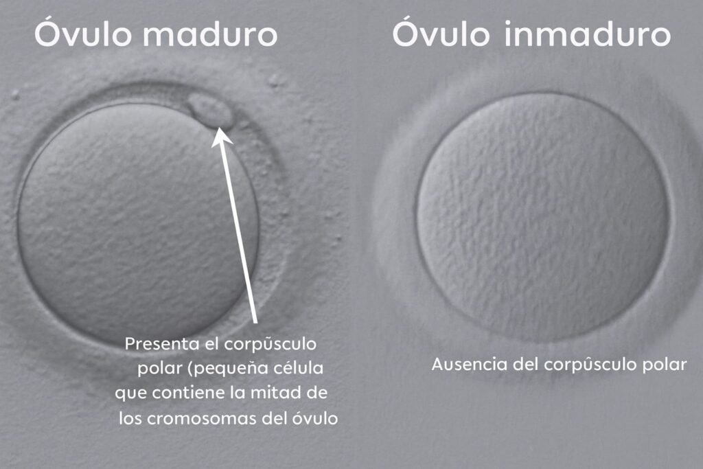 Comparación visual entre un óvulo maduro con corpúsculo polar visible y un óvulo inmaduro sin corpúsculo polar, ilustrando la diferencia morfológica entre ambos estados de maduración ovocitaria.
