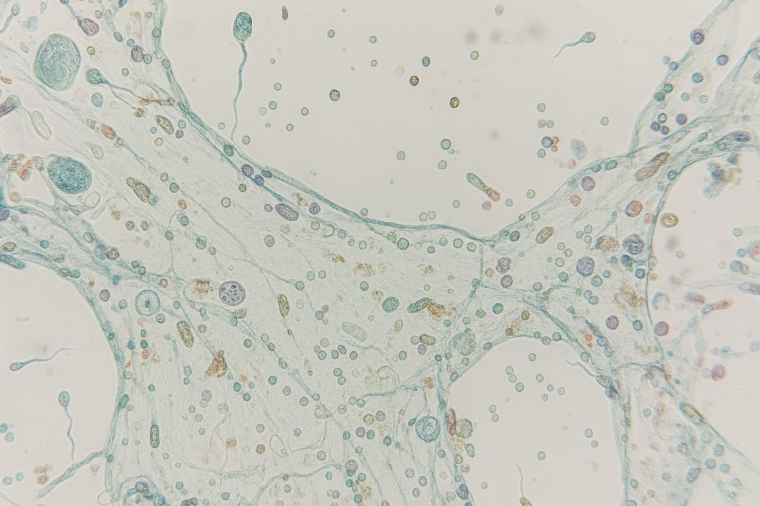 Micrografía  del flujo vaginal humano a gran aumento, mostrando una red de fibras semitransparentes y células redondeadas y alargadas, algunas con forma de espermatozoides. La imagen ilustra la composición celular del moco cervical y su papel en la fertilidad.